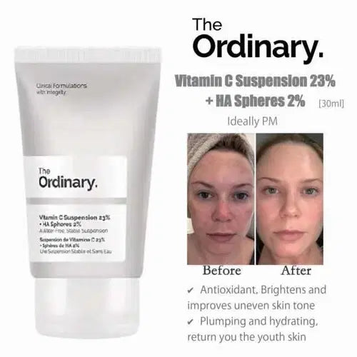 The Ordinary Vitamin C Suspension 30% in Silicone – Brightening & Antioxidant Skin Treatment