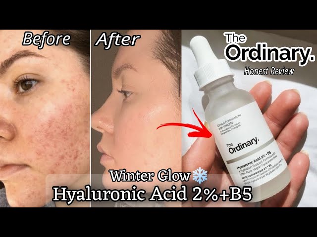 The Ordinary Hyaluronic Acid 2% + B5 – Hydrating Face Serum